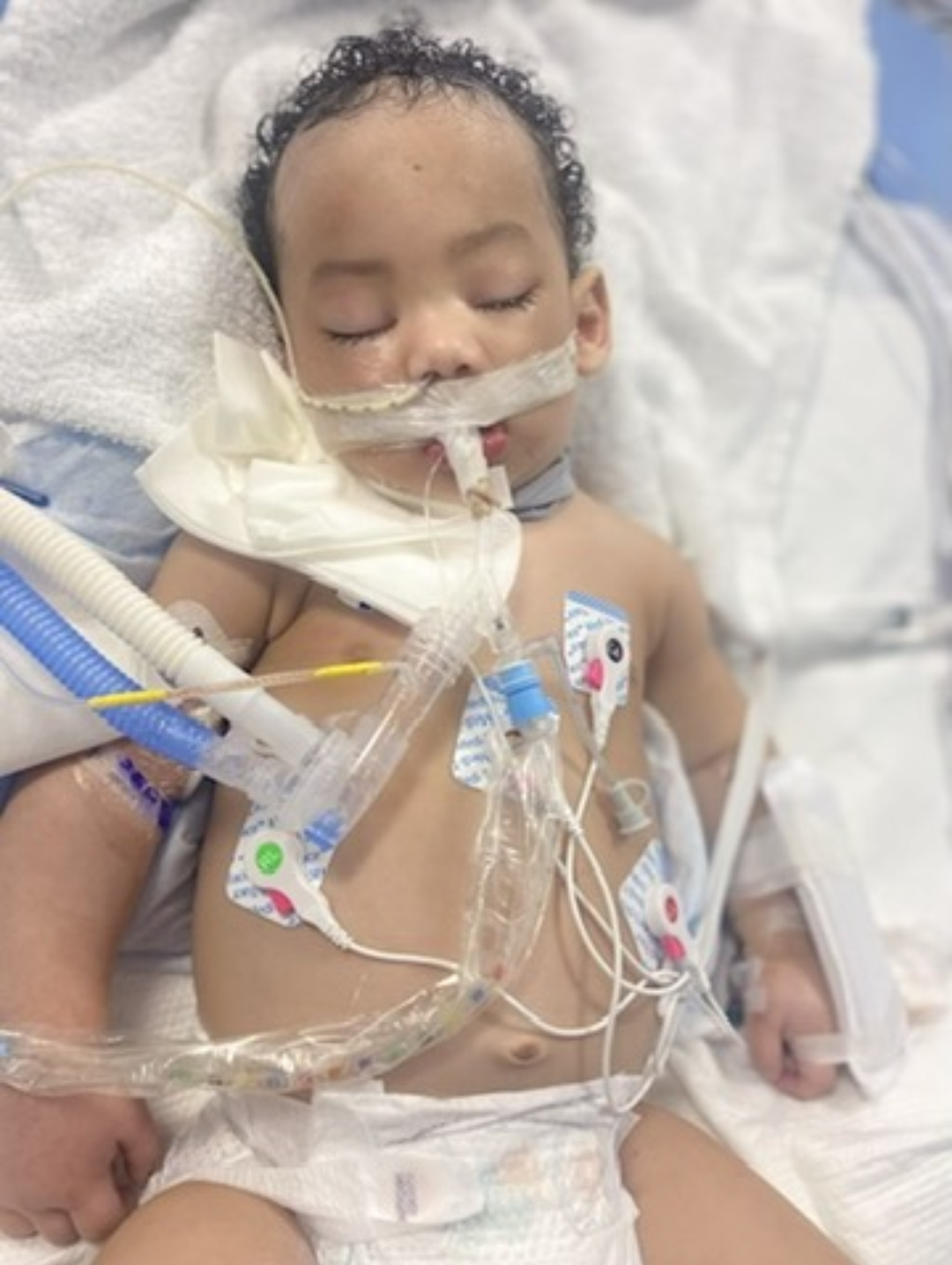 Patient Kiante in hospital bed
